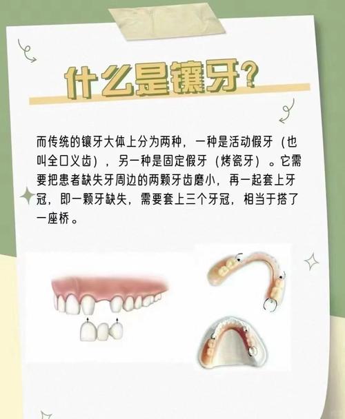 镶牙注意什么