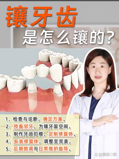 镶牙注意什么
