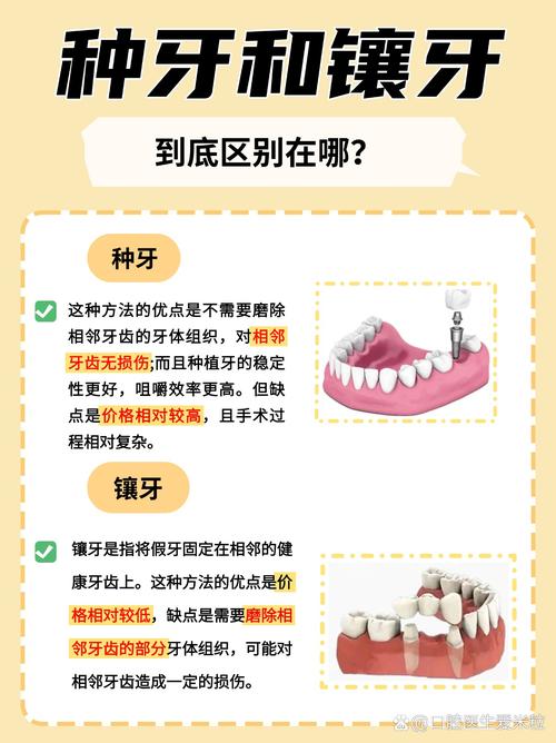 镶牙注意什么