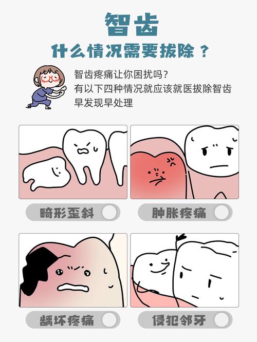 什么情况下要拔智齿