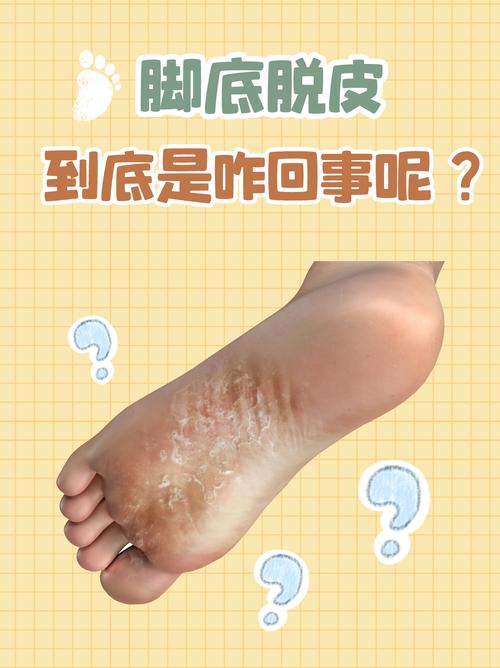 脚干脱皮是什么原因