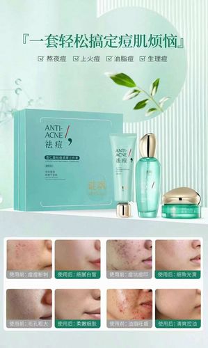 .杏仁酸洗面奶怎么样