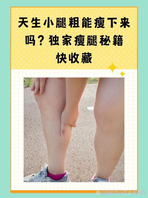 为什么小腿脂肪难减肥