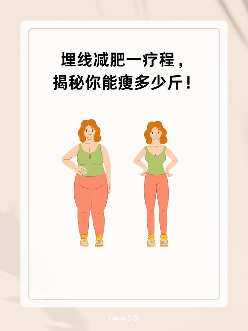 为什么埋线减肥饿