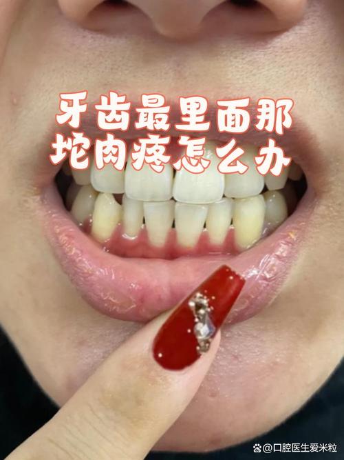板牙疼是什么原因