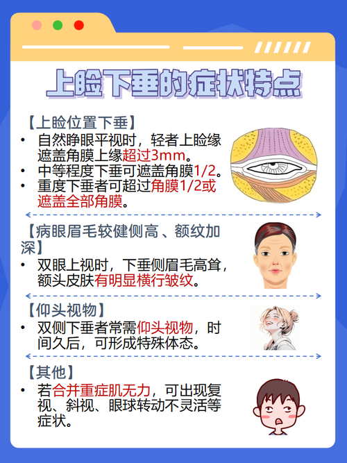 为什么会眼皮下垂