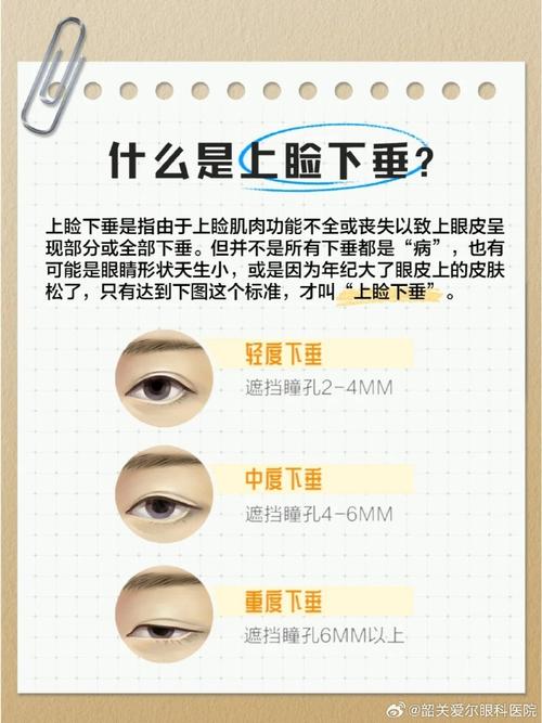 为什么会眼皮下垂