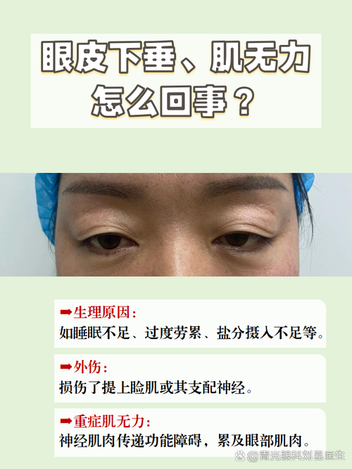 为什么会眼皮下垂