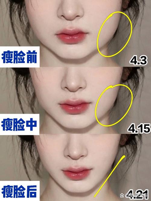 什么时候瘦脸