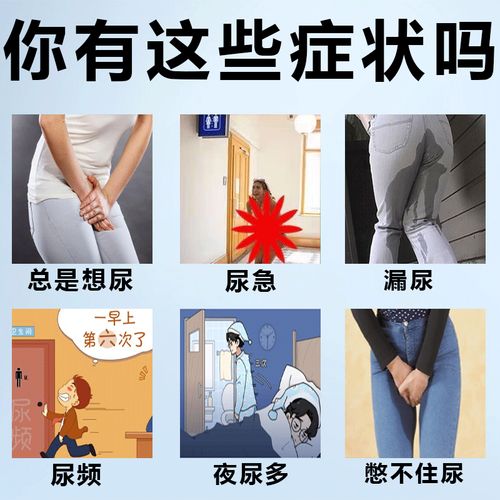 发尿急吃什么药