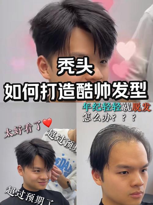 秃顶剪什么发型好看
