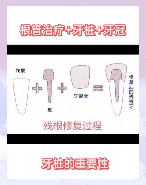 牙齿打桩什么意思