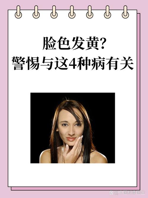 皮肤发黄是缺什么
