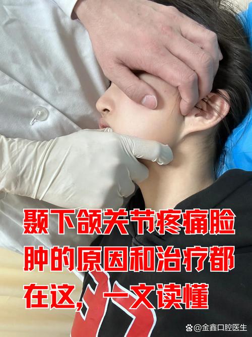 为什么会脸痛