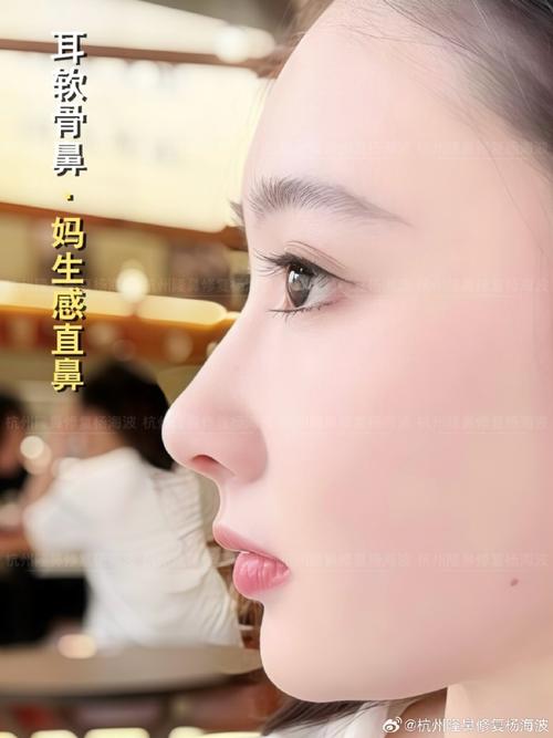 用什么隆鼻好