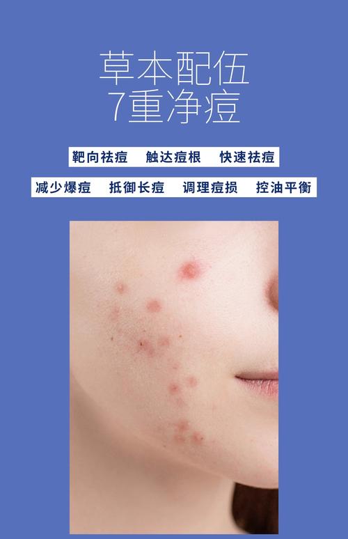 精油减肥为什么回长痘