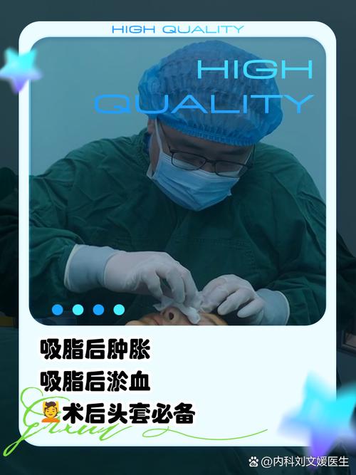 吸脂什么好