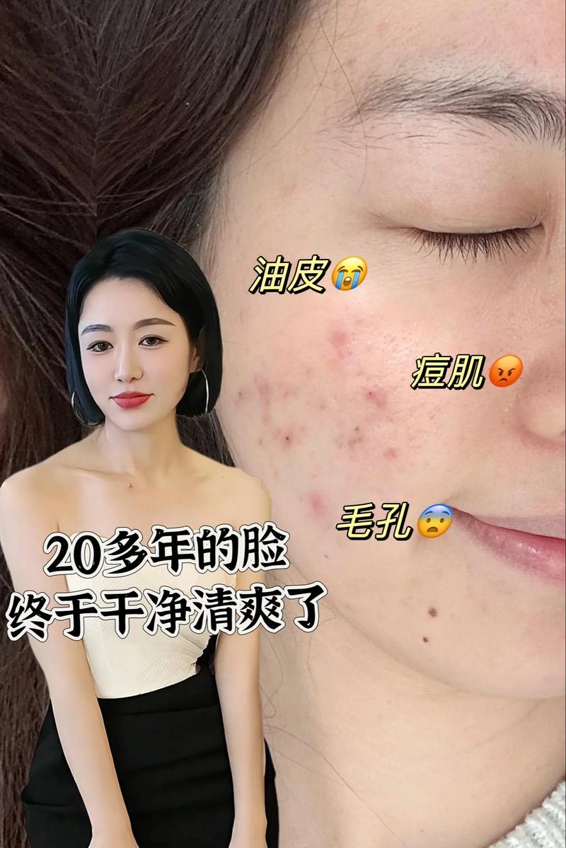 每次洗面奶洗完脸 脸很紧是怎么了