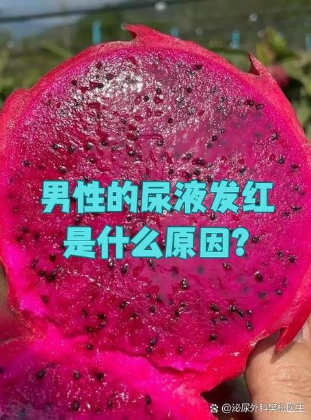 尿呈红色是什么原因