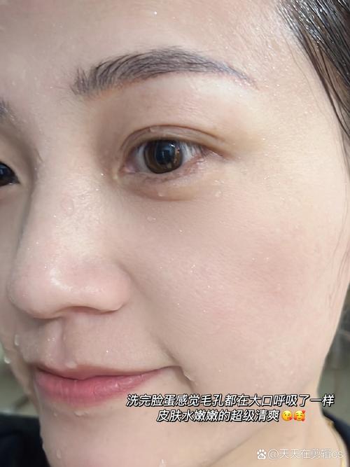 皮肤不好怎么改善什么洗面奶