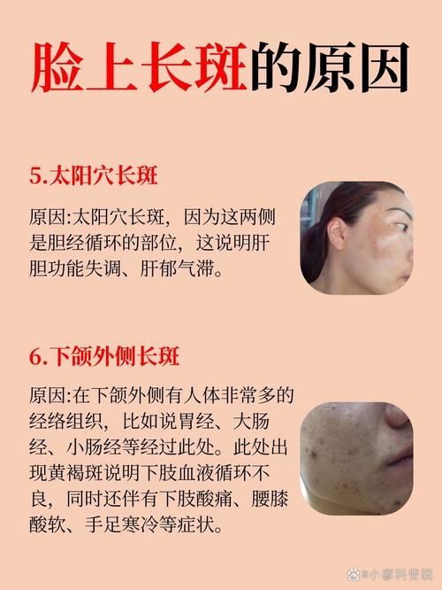 眉毛长斑是什么原因