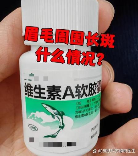 眉毛长斑是什么原因