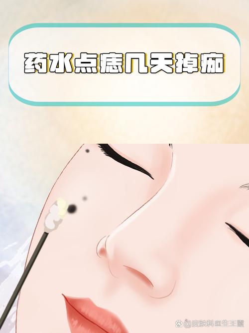 点痣为什么不能碰水