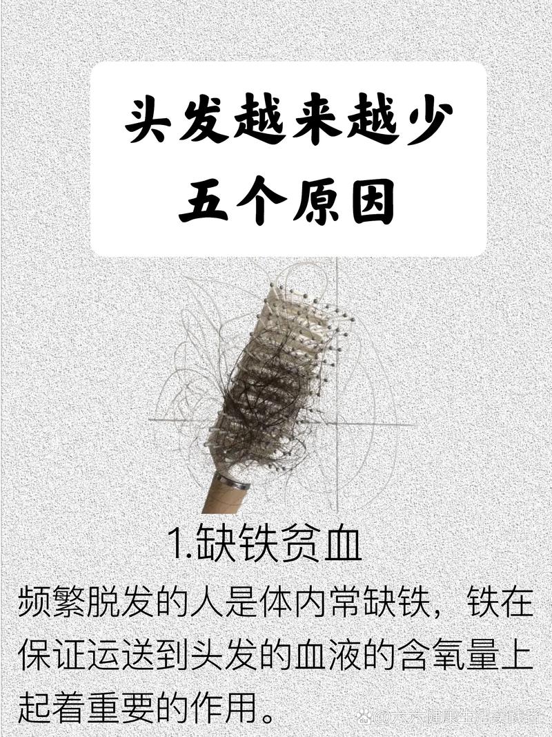 头发少是因为什么