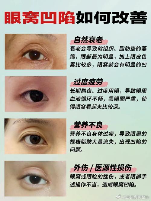 眼角凹陷是什么原因