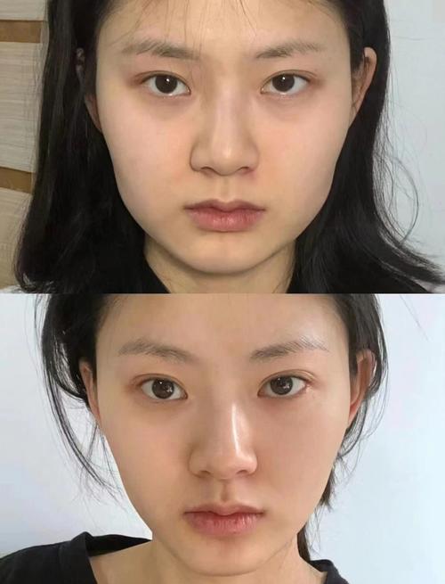 打完瘦脸针什么感觉
