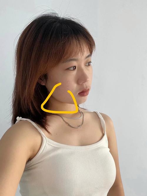 打完瘦脸针什么感觉