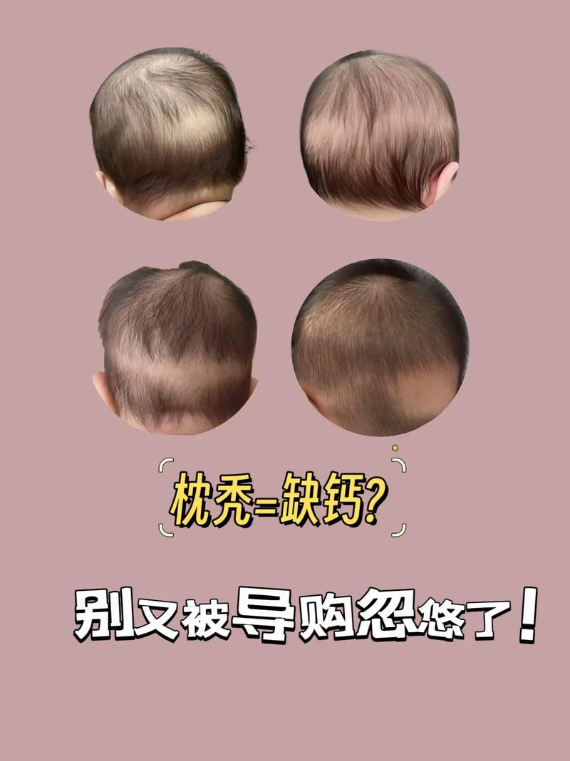 宝宝脱发是什么原因