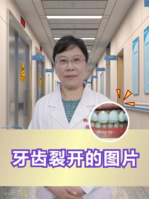 牙齿为什么会断裂