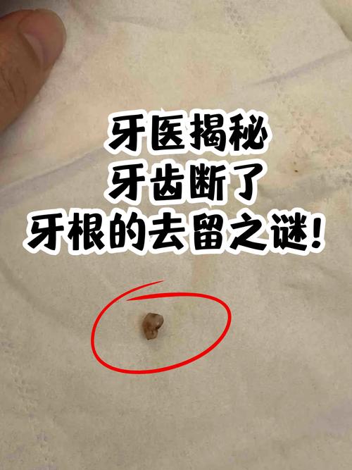 牙齿为什么会断裂