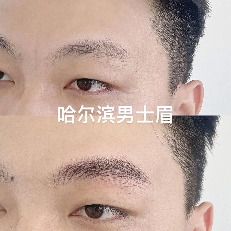 什么是开眉