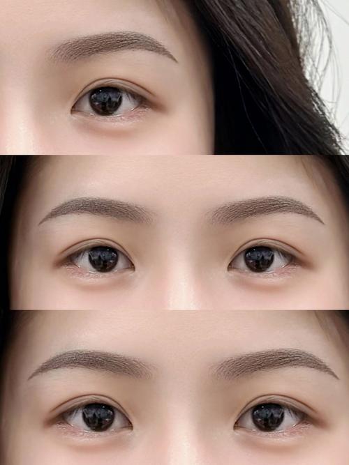 什么是开眉