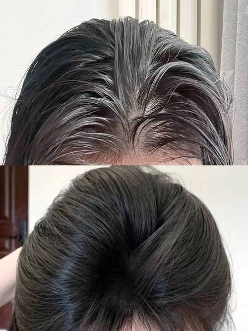 头发油洗什么