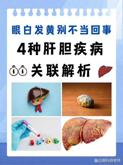 黄染是什么