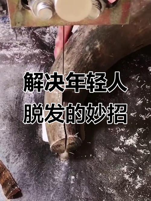 程序员为什么掉头发