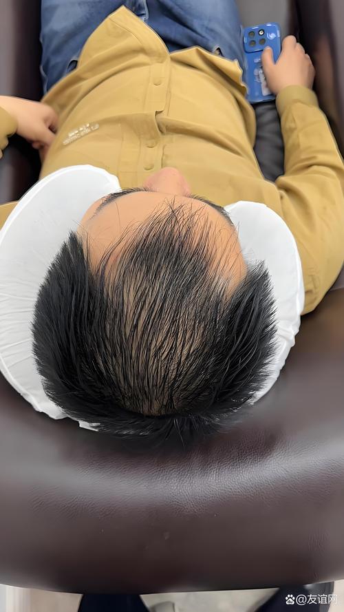 程序员为什么掉头发