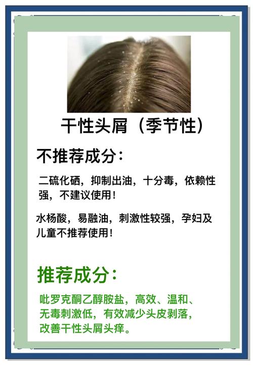 长头屑是什么原因