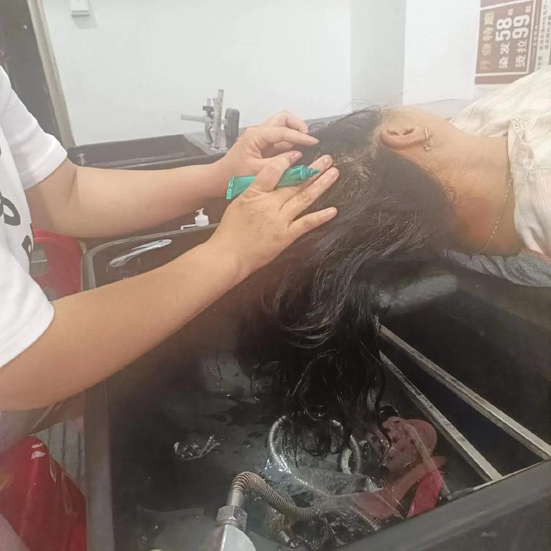 长头屑是什么原因