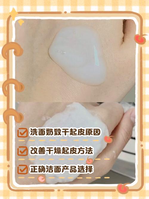 用洗面奶脸爆皮怎么办