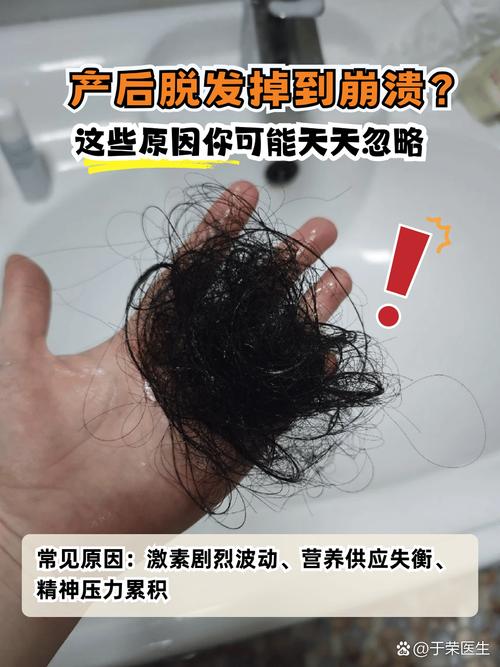 产后掉发什么原因