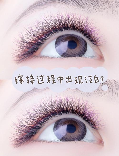 睫毛变白是什么原因