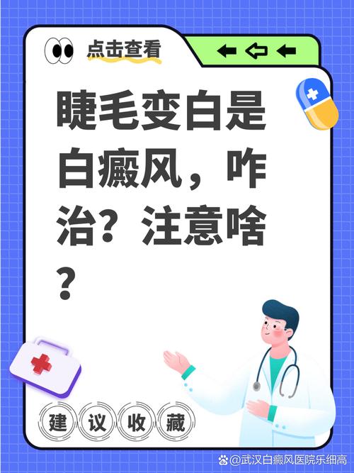 睫毛变白是什么原因