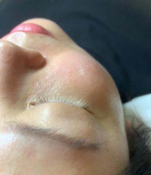 睫毛变白是什么原因