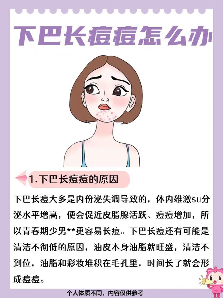 下巴长痤疮什么原因