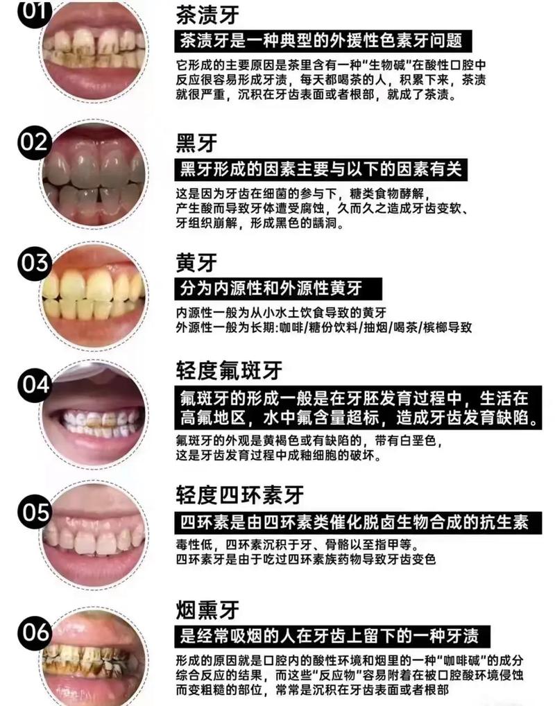 门牙变黑是什么原因