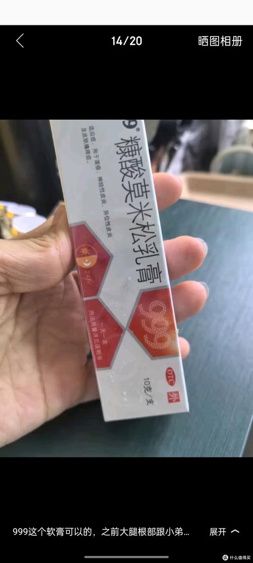 皮肤增生用什么药膏